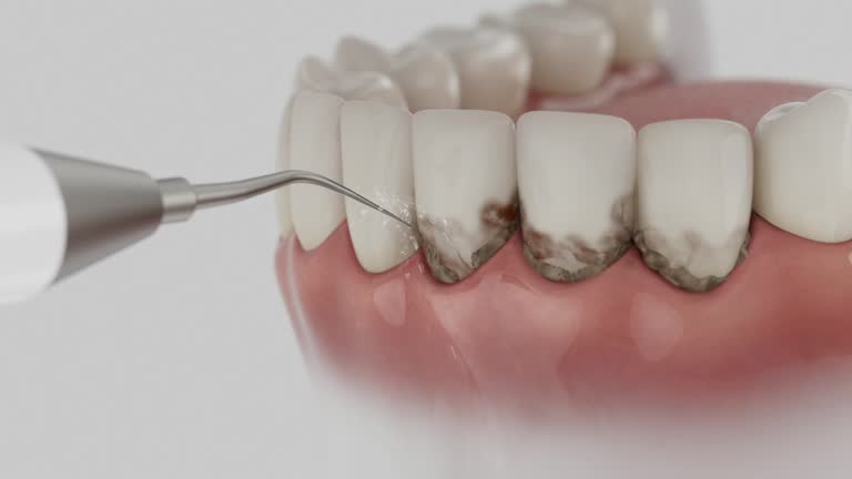 Trusted Teeth Cleaning And Checkup service in Claremore, OK - Dentist Open Now